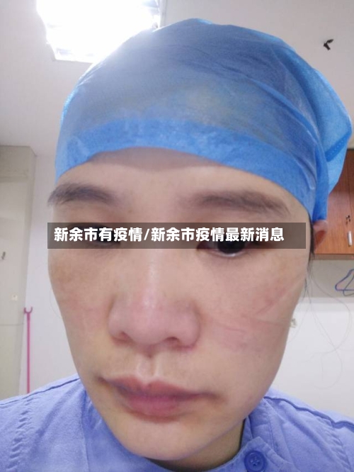 新余市有疫情/新余市疫情最新消息