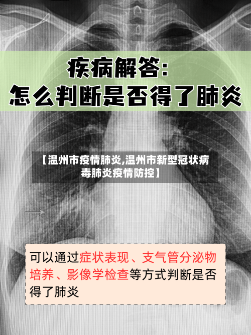 【温州市疫情肺炎,温州市新型冠状病毒肺炎疫情防控】-第1张图片